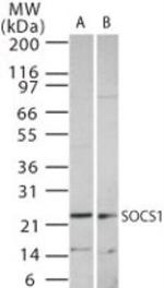 SOCS1 Antibody in Western Blot (WB)