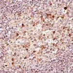 NOXA Antibody in Immunohistochemistry (Paraffin) (IHC (P))