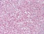 TRF2 Antibody in Immunohistochemistry (Paraffin) (IHC (P))