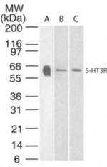 HTR3A Antibody in Western Blot (WB)