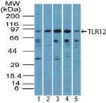 TLR12 Antibody in Western Blot (WB)