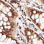 HDAC3 Antibody in Immunohistochemistry (Paraffin) (IHC (P))