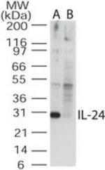 IL24 Antibody in Western Blot (WB)