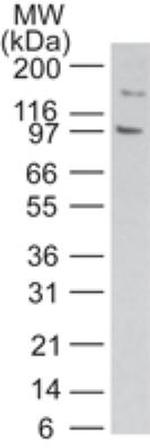 TLR11 Antibody in Western Blot (WB)