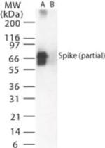 SARS Coronavirus Spike Protein Antibody in Western Blot (WB)