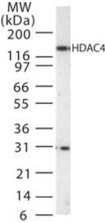 HDAC4 Antibody in Western Blot (WB)