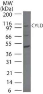 CYLD Antibody in Western Blot (WB)