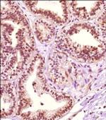 PRMT4 Antibody in Immunohistochemistry (Paraffin) (IHC (P))