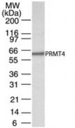 PRMT4 Antibody in Western Blot (WB)