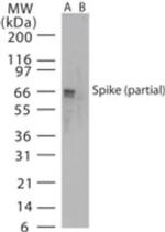 SARS Coronavirus Spike Protein Antibody in Western Blot (WB)