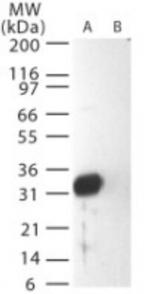 SARS Coronavirus Matrix Antibody in Western Blot (WB)