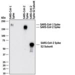 SARS Coronavirus Spike Protein Antibody in Western Blot (WB)