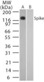 SARS Coronavirus Spike Protein Antibody in Western Blot (WB)