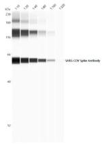 SARS Coronavirus Spike Protein Antibody in Western Blot (WB)