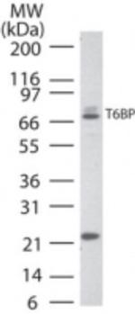 TAX1BP1 Antibody in Western Blot (WB)