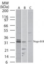 Nogo Receptor Antibody in Western Blot (WB)