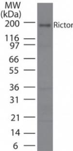 RICTOR Antibody in Western Blot (WB)