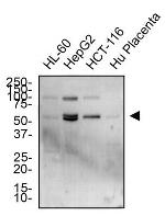 TRAIL-R2 (DR5) Antibody in Western Blot (WB)