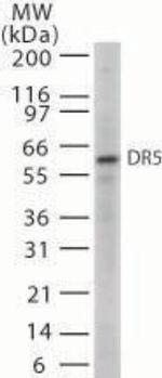 TRAIL-R2 (DR5) Antibody in Western Blot (WB)