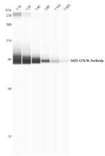 SARS Coronavirus Nucleocapsid Antibody in Western Blot (WB)