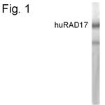 RAD17 Antibody in Western Blot (WB)