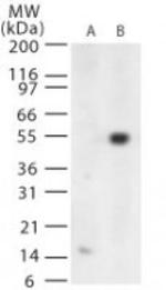 West Nile Virus Envelope Antibody in Western Blot (WB)