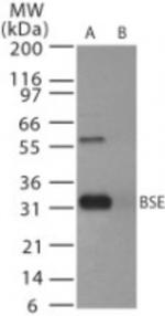 PrP Antibody in Western Blot (WB)