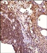 STAT1 Antibody in Immunohistochemistry (Paraffin) (IHC (P))