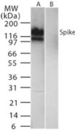 SARS Coronavirus Spike Protein Antibody in Western Blot (WB)