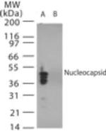 SARS Coronavirus Nucleocapsid Antibody in Western Blot (WB)