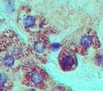 GRP78 Antibody in Immunohistochemistry (Paraffin) (IHC (P))