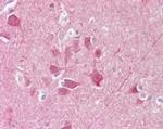 PGP9.5 Antibody in Immunohistochemistry (Paraffin) (IHC (P))