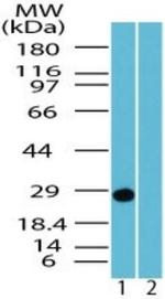 PGP9.5 Antibody in Western Blot (WB)