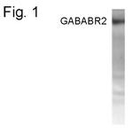 GABARAP Antibody in Western Blot (WB)