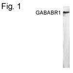 GABARAP Antibody in Western Blot (WB)