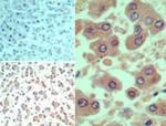 SMAD3 Antibody in Immunohistochemistry (Paraffin) (IHC (P))