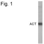 SERPINA3 Antibody in Western Blot (WB)