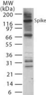 SARS Coronavirus Spike Protein Antibody in Western Blot (WB)