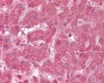 NDUFA13 Antibody in Immunohistochemistry (Paraffin) (IHC (P))