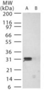 PrP Antibody in Western Blot (WB)