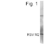 RSV M2 Antibody in Western Blot (WB)