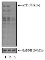 ATR Antibody