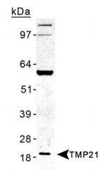 TMP21 Antibody in Western Blot (WB)