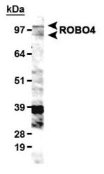 ROBO4 Antibody in Western Blot (WB)