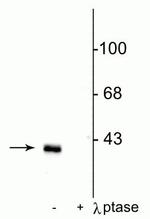 Phospho-DARPP-32 (Thr75) Antibody in Western Blot (WB)