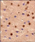 BMAL1 Antibody in Immunohistochemistry (Paraffin) (IHC (P))