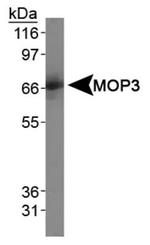 BMAL1 Antibody in Western Blot (WB)