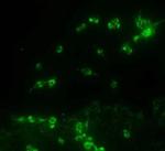 TRPA1 Antibody in Immunocytochemistry (ICC/IF)