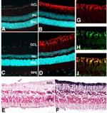 Glutamine Synthetase Antibody in Immunohistochemistry (Paraffin) (IHC (P))