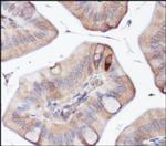 ATG5 Antibody in Immunohistochemistry (Paraffin) (IHC (P))